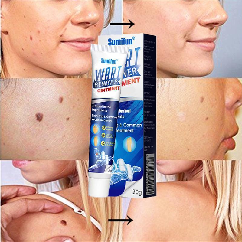 Wart and Tag Remover Cream