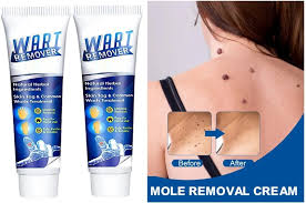 Wart and Tag Remover Cream