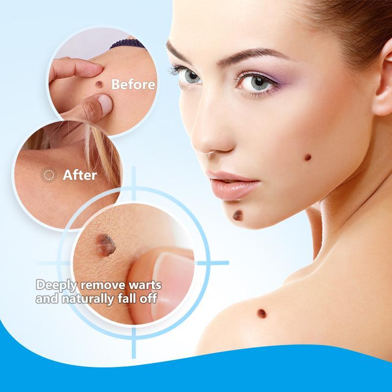 Wart and Tag Remover Cream
